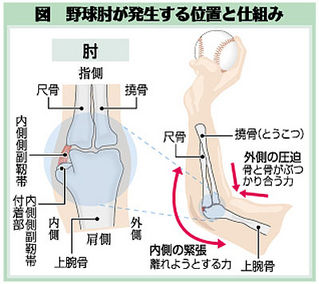 （上）野球肘が発生する位置と仕組み