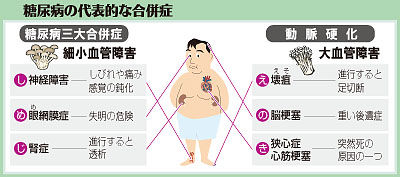 （中）　糖尿病の代表的な合併症