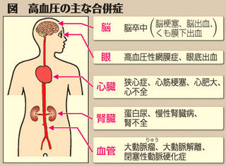 （下）図　高血圧の主な合併症