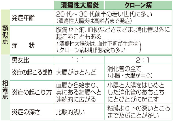 （中）　潰瘍性大腸炎とクローン病の類似点と相違点