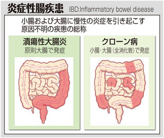 （中）　炎症性腸疾患