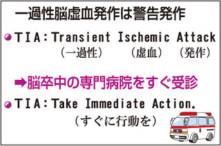 （上）　一過性脳虚血発作