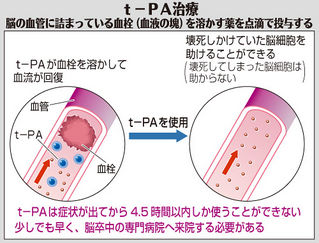 （中）図　t-PA治療