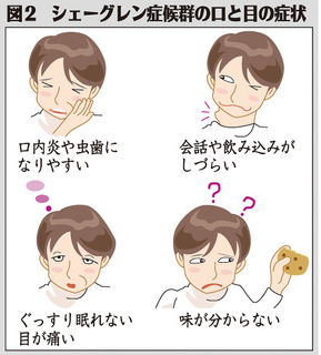 （上）図２　シェーグレン症候群口と目の症状