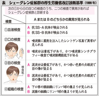 （下）表　シェーグレン症候群の厚生労働省改訂診断基準