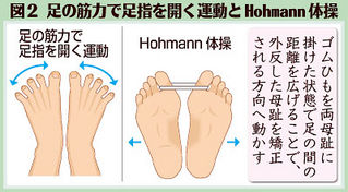 (上）図2　足の筋力で足指を開く運動とHohmann体操