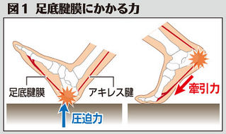 （中）　図１　足底腱膜にかかる力